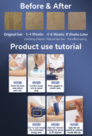 MLAY T14 Epilator Laser Hair Removal Machine IPL ICE Hair Removal Home Laser Epilator Replaceable Lens For Women Men Painless