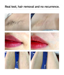 MLAY T14 Epilator Laser Hair Removal Machine IPL ICE Hair Removal Home Laser Epilator Replaceable Lens For Women Men Painless