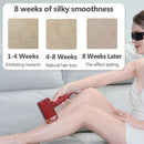 MLAY T14 Epilator Laser Hair Removal Machine IPL ICE Hair Removal Home Laser Epilator Replaceable Lens For Women Men Painless